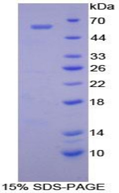 Human Recombinant Cadherin, Retinal (RCAD)