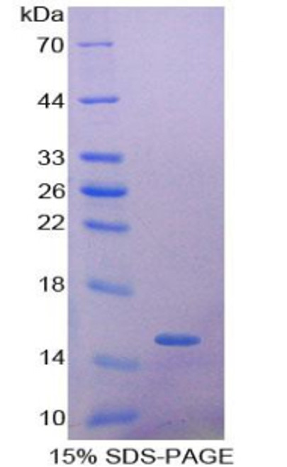 Mouse Recombinant Alpha-Hemoglobin Stabilizing Protein (aHSP)