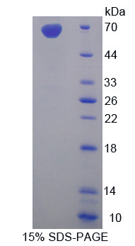 Rat Recombinant Mucin 1 (MUC1)