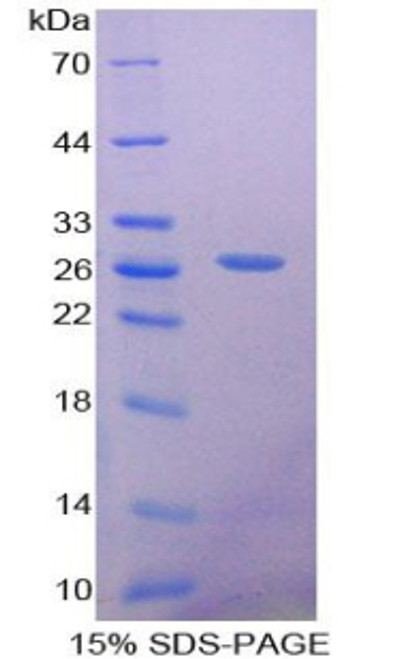 Rat Recombinant Sex Determining Region Y Box Protein 18 (SOX18)