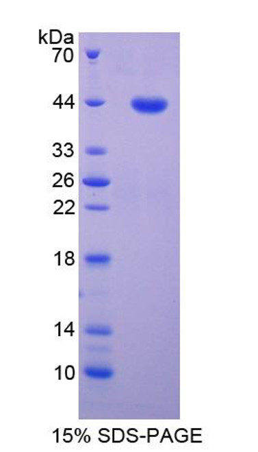 Human Recombinant Myelin Associated Glycoprotein (MAG)