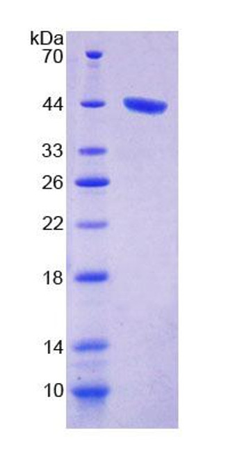 Human Recombinant Protein Kinase C Delta (PKCd)