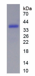 Human Recombinant Heat Shock Transcription Factor 1 (HSF1)