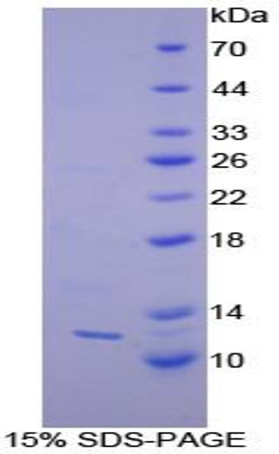 Human Recombinant Prohibitin (PHB)