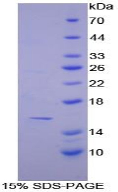 Human Recombinant Caspase 7 (CASP7)