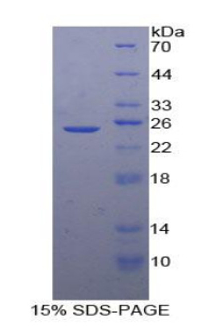 Human Recombinant Stromal Cell Derived Factor 2 (SDF2)