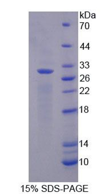 Rat Native Myoglobin (MYO)