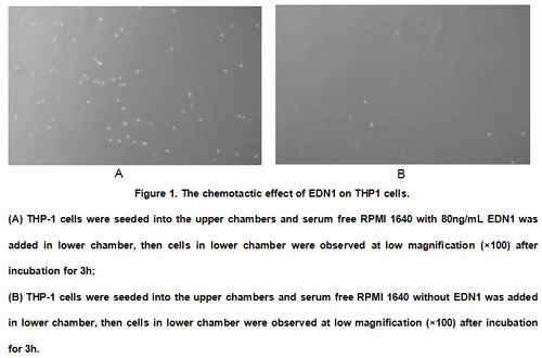 Rat Active Endothelin 1 (EDN1)