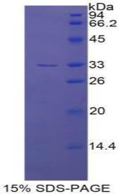 Human Recombinant Endothelin Converting Enzyme 1 (ECE1)