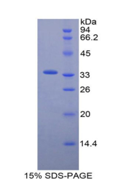 Mouse Recombinant Endothelin Converting Enzyme 1 (ECE1)