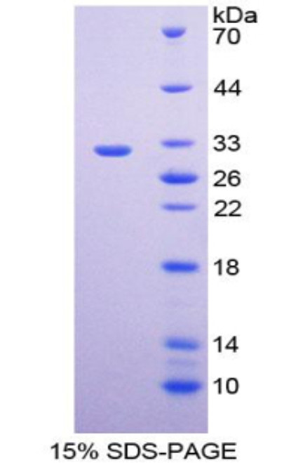 Rat Recombinant Endothelin Converting Enzyme 1 (ECE1)