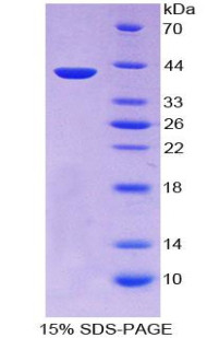 Human Recombinant Keratin 3 (KRT3)