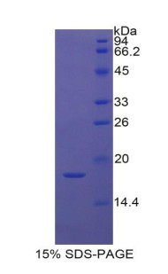 Rat Recombinant Keratin 1 (KRT1)