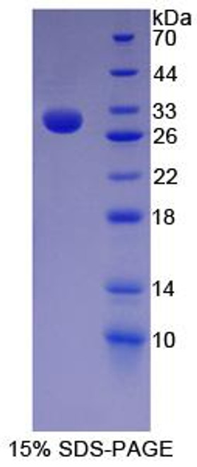 Human Recombinant Nestin (NES)