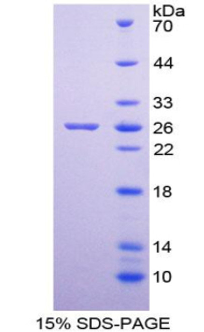 Human Recombinant Interleukin Enhancer Binding Factor 3 (ILF3)