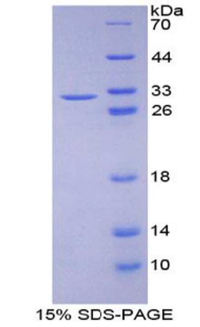 Mouse Recombinant Ataxin 1 (ATXN1)