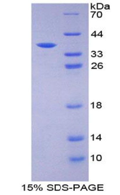 Mouse Recombinant Protein Kinase R (PKR)