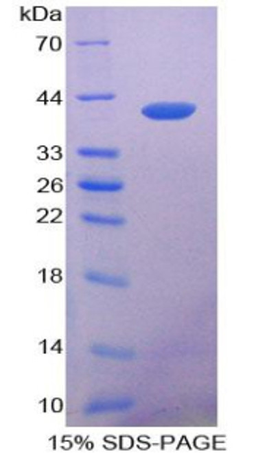 Rat Recombinant Keratin 14 (KRT14)