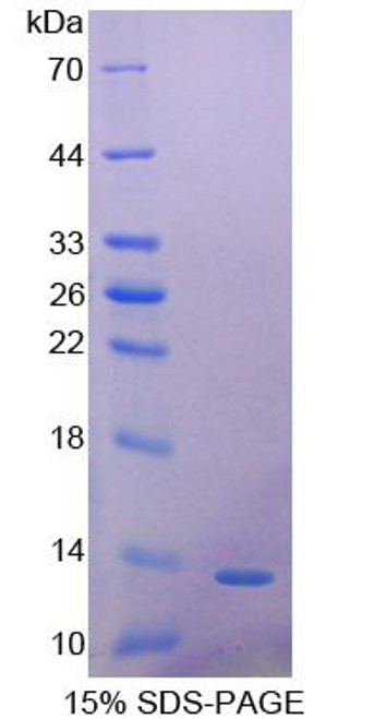 Human Recombinant Platelet Derived Growth Factor AA (PDGFAA)