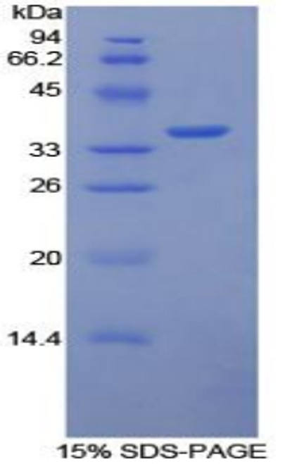 Rabbit Recombinant Tissue Factor (TF)