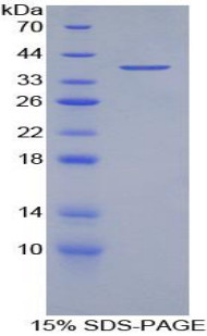 Human Recombinant Myelin Basic Protein (MBP)