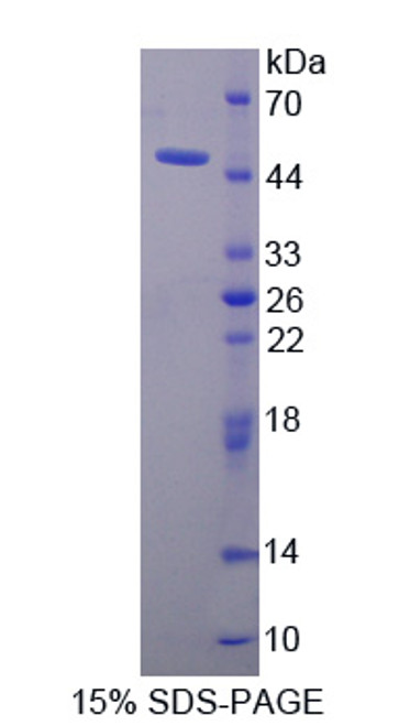 Horse Recombinant Tissue Inhibitors Of Metalloproteinase 1 (TIMP1)