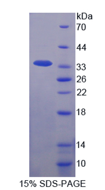Cattle Recombinant Interleukin 1 Beta (IL1b)