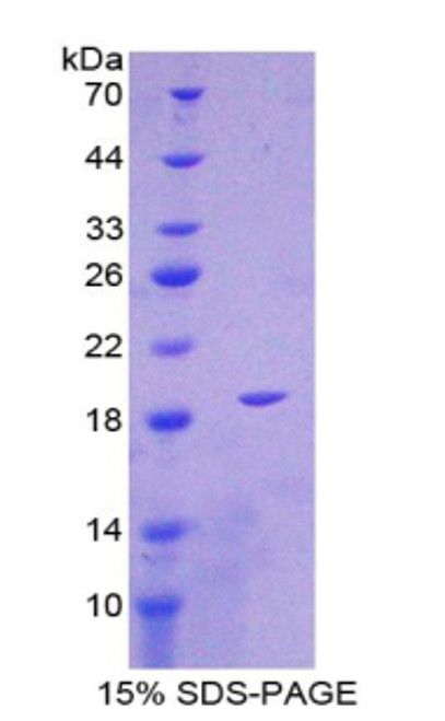 Human Recombinant Interleukin 1 Delta (FIL1d)