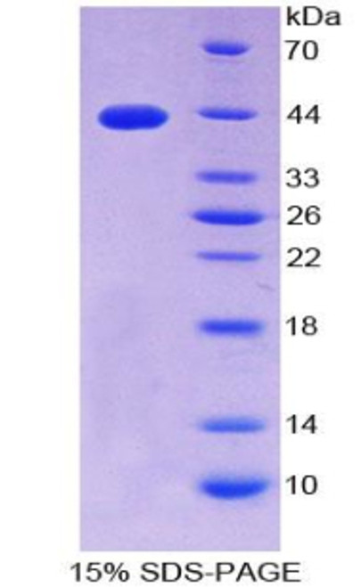 Cattle Recombinant S100 Calcium Binding Protein B (S100B)