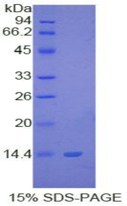 Human Recombinant S100 Calcium Binding Protein B (S100B)