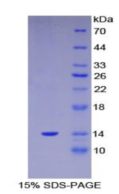 Human Recombinant S100 Calcium Binding Protein A11 (S100A11)