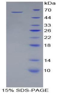 Pig Recombinant Heme Oxygenase 1, Decycling (HO1)