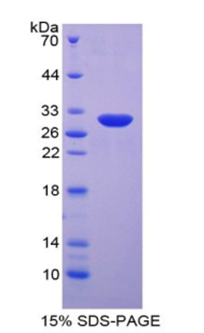 Human Recombinant Superoxide Dismutase, Copper Chaperone (SOD4)