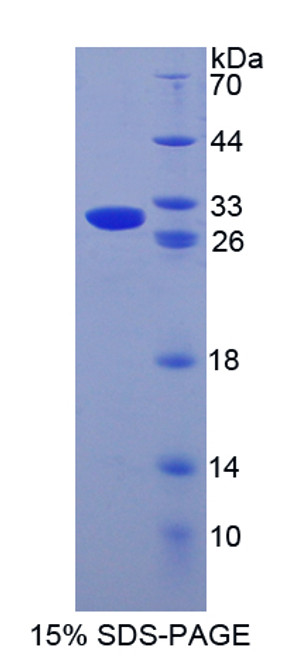 Human Recombinant Granzyme B (GZMB)