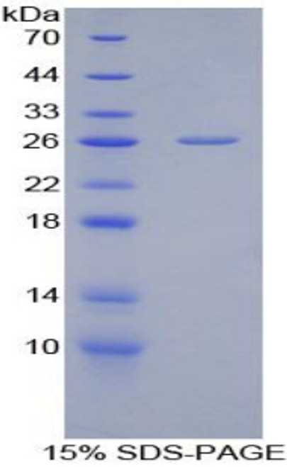 Chicken Recombinant Adiponectin (ADP)