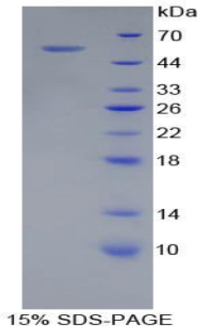 Pig Recombinant Adiponectin (ADP)