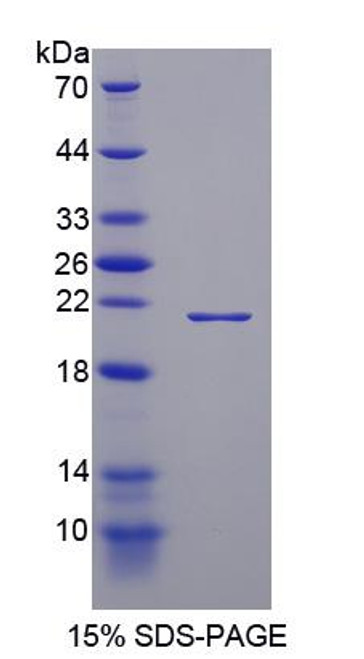 Mouse Recombinant Thrombospondin 1 (THBS1)