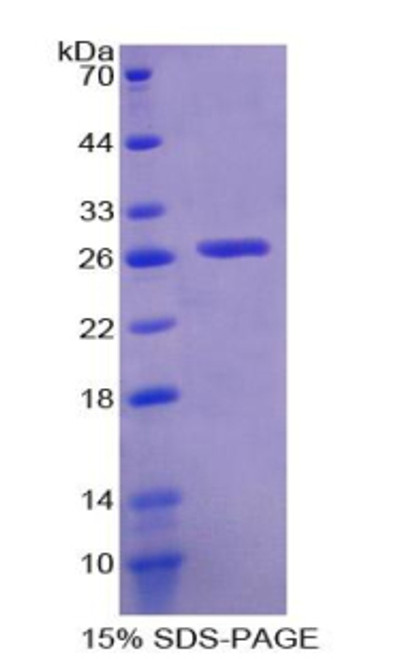 Mouse Recombinant Glutathione S Transferase Theta 2 (GSTt2)