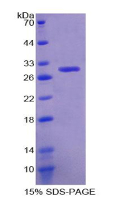 Mouse Recombinant Glutathione S Transferase Theta 1 (GSTt1)