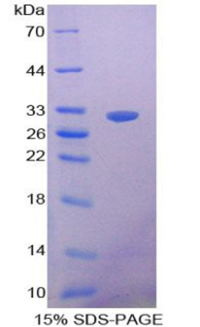 Human Recombinant Nitric Oxide Synthase Trafficker (NOSTRIN)