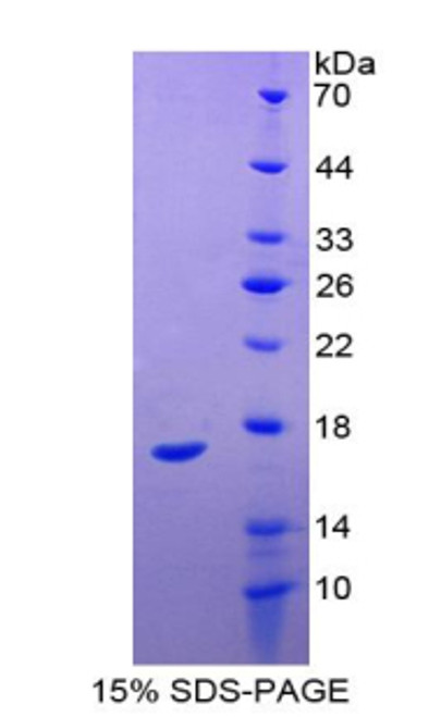 Human Recombinant Midkine (MK) Human Recombinant Midkine (MK)