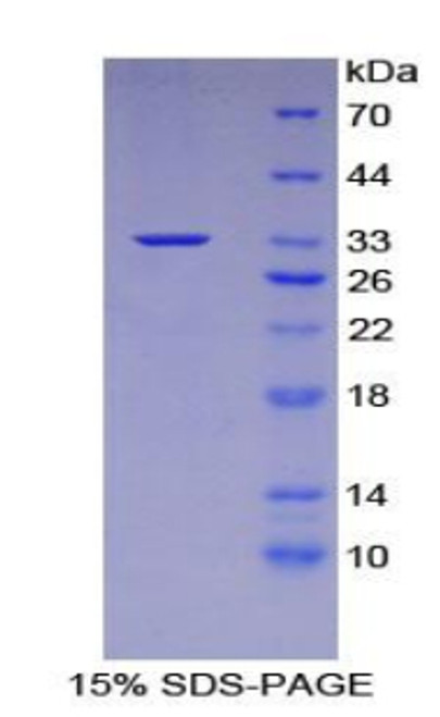 Human Recombinant Advanced Glycosylation End Product Specific Receptor (AGER)