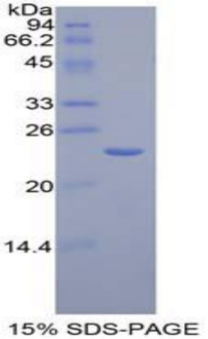 Mouse Recombinant Advanced Glycosylation End Product Specific Receptor (AGER)