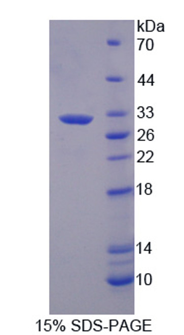 Cattle Recombinant Hyaluronan Binding Protein 1 (HABP1)