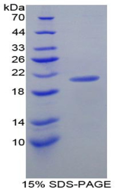 Mouse Recombinant Diamine Oxidase (DAO)