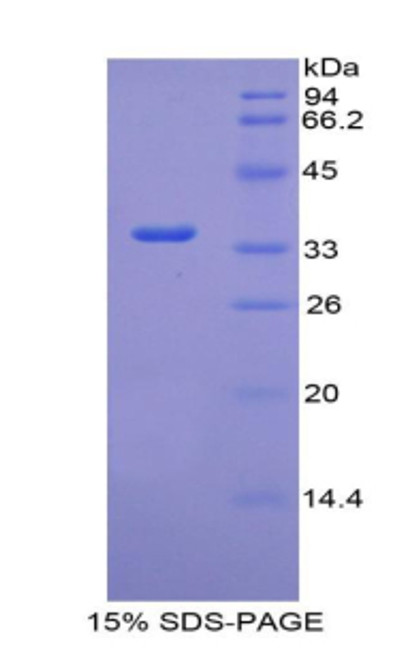 Human Recombinant Coagulation Factor V (F5)
