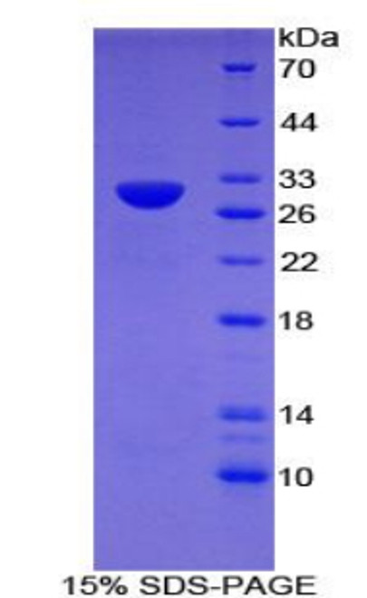 Mouse Recombinant Toll Like Receptor 6 (TLR6)