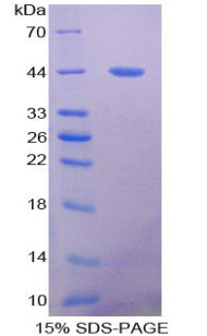 Rat Recombinant Mucin 5 Subtype B (MUC5B)