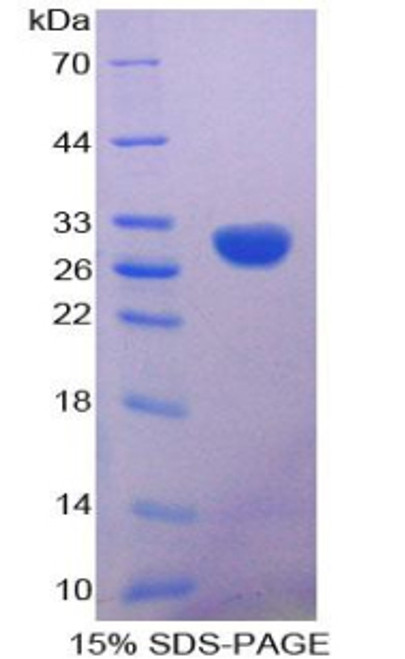 Human Recombinant Calretinin (CR)