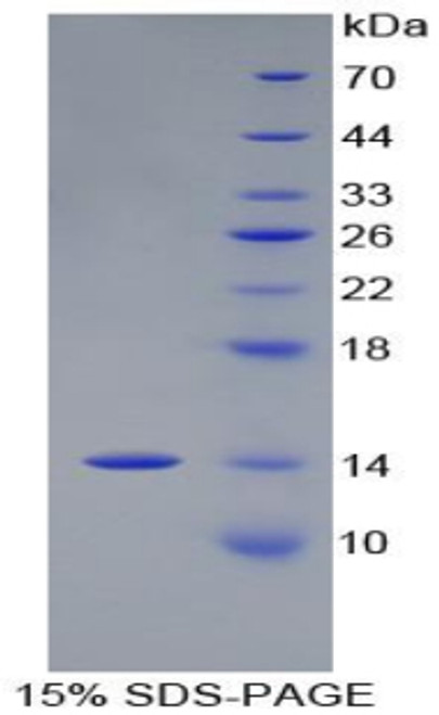 Chicken Recombinant Procalcitonin (PCT)